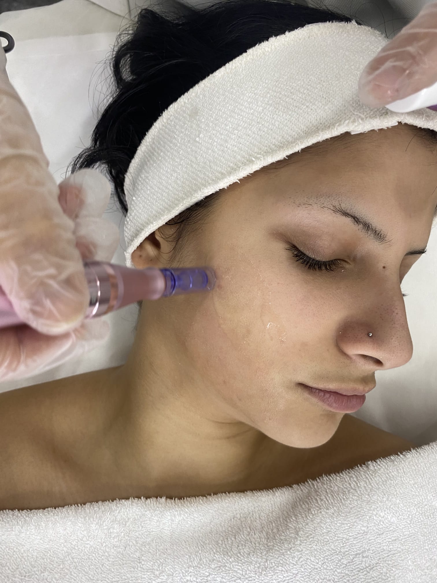 Tratamentos para rosto