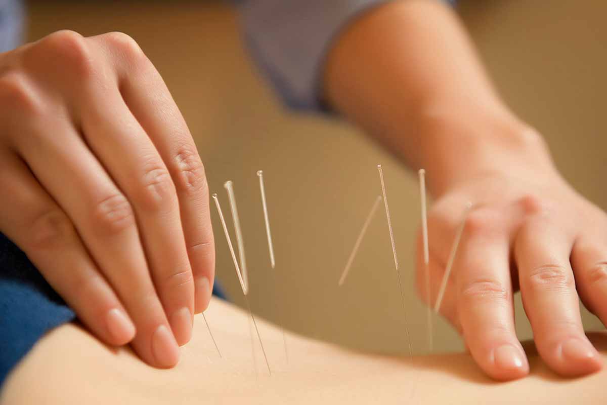 Medicina Tradicional Chinesa